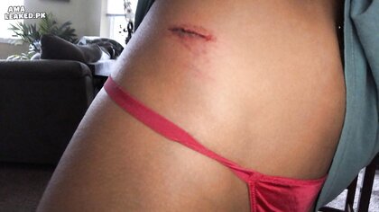 Ⓛⓔⓐⓚⓔⓓ - Olivia H